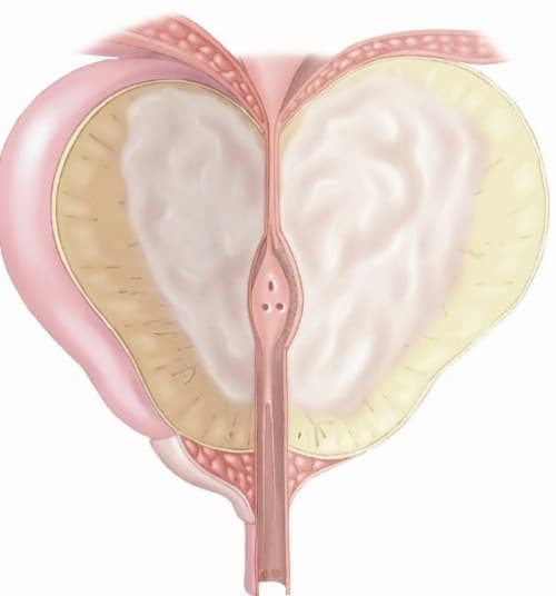 Urenol วิธีการใช้